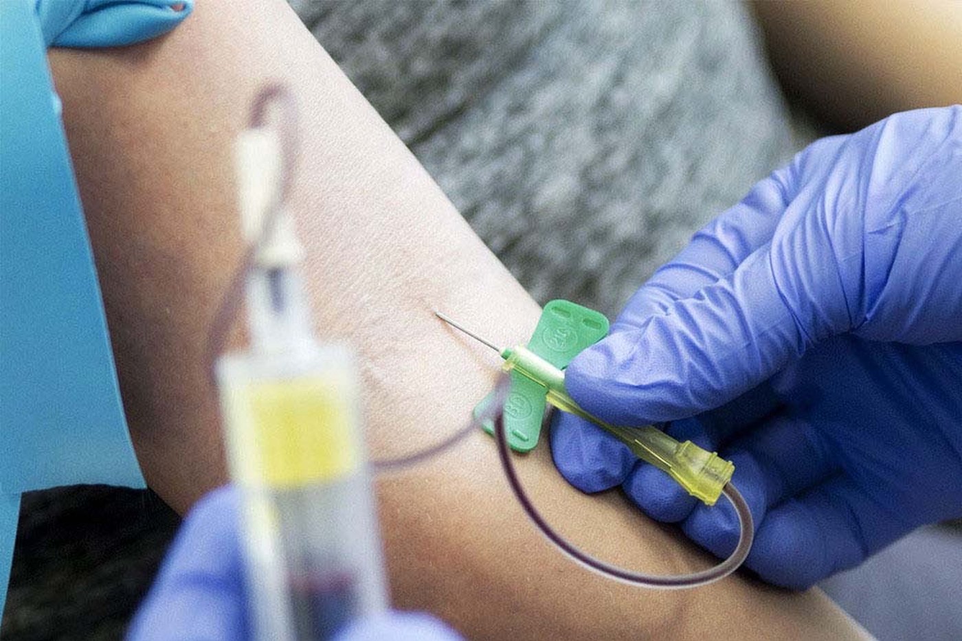 Platelet Rich Plasma – blodplatebehandling