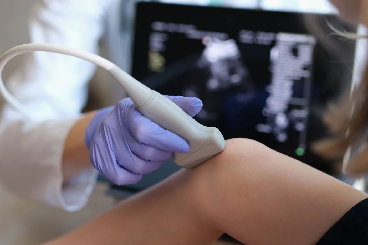 Diagnostisk ultralyd av kne