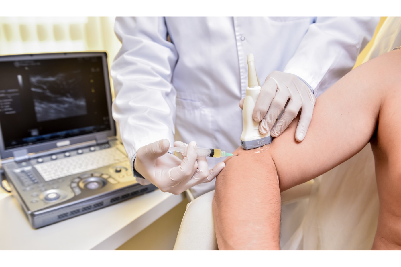 Ultrasound-guided injection treatment